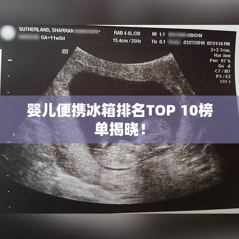 嬰兒便攜冰箱排名TOP 10榜單揭曉！